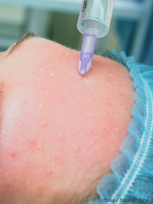 Mesotherapie